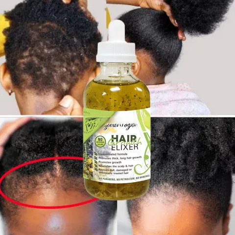 Hot Herbal Hair Oil Hair Care Liquid Hair Growth Dense Hair Rosemary Repair Dense Hair Essential Oil Hair Care Essential Oil